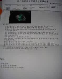 小排畸检查什么内容 大排畸检查内容是什么