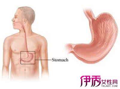 胃下垂有什么症状 胃下垂有什么症状 胃下垂6大症状