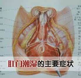 内痔会导致肛门潮湿吗 肛门潮湿 这些因素会导致肛门潮湿