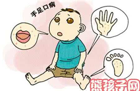 手足口病一定要输液吗 手足口病注意什么 有关手足口病,妈妈们一定要注意!