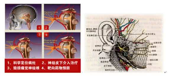 运动神经元病能治吗 运动神经元病 得了运动神经元病应该怎么治