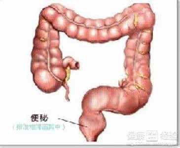 肛门大便的时候出血 肛门出血 大便时肛门出血是什么问题