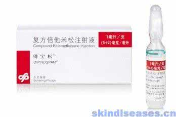 复方倍他米松是激素吗 复方倍他米松注射液