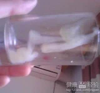 精液有血丝怎么回事 男子精液有血丝 精液里有血丝？大家都来看看吧！
