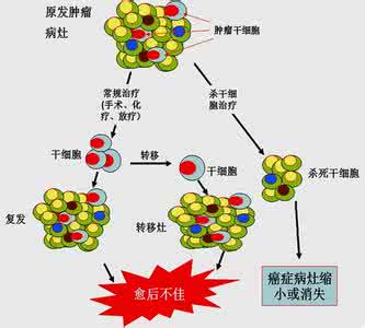 癌症治疗 致癌原因与癌症治疗（5-7）