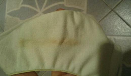 白带异常的症状表现 白带异常是什么症状 白带异常的表现症状