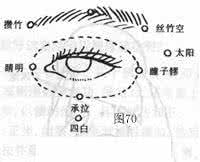 干眼病 按摩眼皮和3穴位改善绿内障、白内障、干眼病