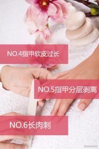 刻不容缓 指尖困扰TOP6！修复问题甲刻不容缓