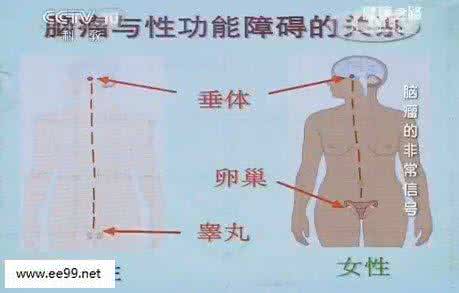 健康之路笔记 健康之路20150331视频和笔记:脑肿瘤症状,视力下降的原因