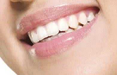 牙齿美白修复多少钱 牙齿美白修复多少钱 牙齿美白 牙齿不整齐先修复后美白