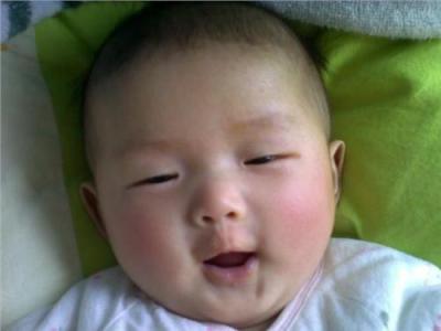 小孩奶粉过敏症状 小孩奶粉过敏怎么办 宝宝奶粉过敏有哪些症状