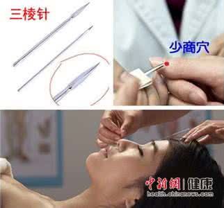 针刺放血疗法 针刺放血疗法 其实可以这样痊愈,针刺放血之感冒!