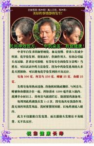 伤寒后遗症民间验方 【民间验方】图荐《民间神效验方：‘中药染发’有益健康！》