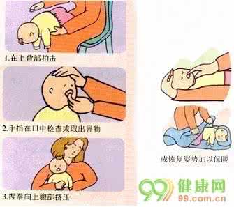 急救常识 18种意外事故急救常识 遇见意外事故正确急救的方法
