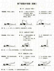 胃下垂 胃下垂医疗体操-