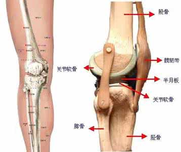 膝关节炎贴什么膏药好 白金膏治疗膝骨关节炎的临床疗效