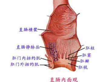 直肠癌的早期症状 直肠炎的症状
