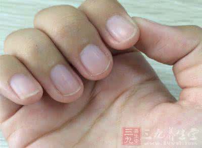 营养不良性水肿 营养不良性水肿 关爱贫困儿童的营养问题