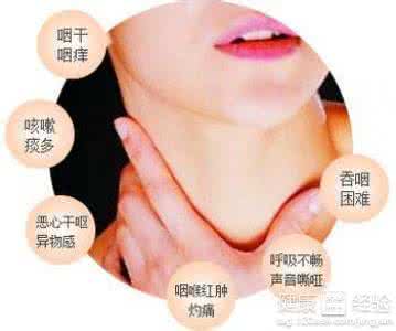 咽喉炎最佳治疗方法 【五官保健】急性咽喉炎的治疗方法，对症下药
