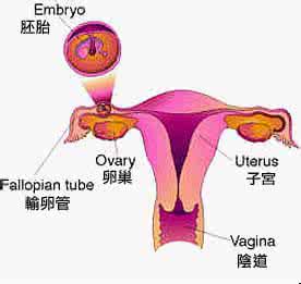 宫外孕常见原因 病因:宫外孕的常见发病原因