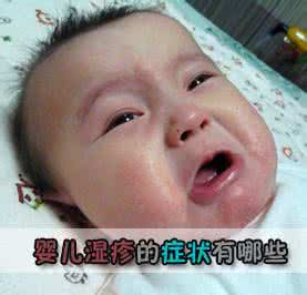 湿疹的病因及治疗方法 新生儿脸部湿疹病因和治疗方法