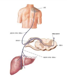 胆囊息肉的症状及治疗 胆囊息肉症状及治疗 治疗胆囊息肉 胆囊息肉可以这样治疗