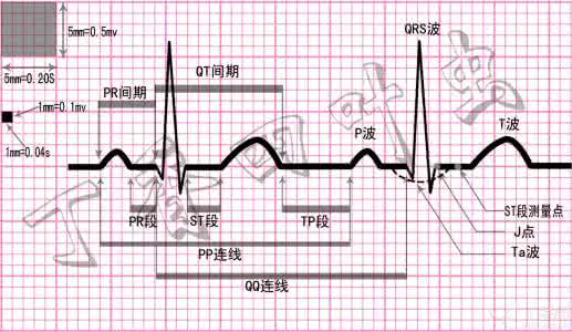研判 探秘心电图：四步搞定ST段研判