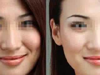 脸上长斑怎么调理 早晨喝一次，脸上斑全没