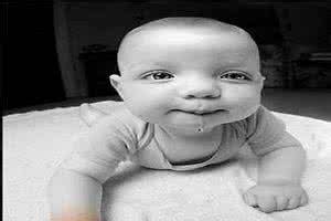 呆小症图片 呆小症 呆小症(图)