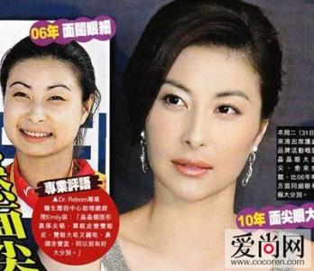 郭晶晶整容 郭晶晶整容前后 从郭晶晶整容说说所谓女人“旺夫相”
