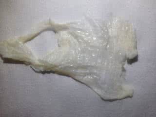 水样白带是什么原因 白带多像水样是什么原因