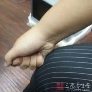 肠道过敏 甲鱼过敏 吃甲鱼过敏怎么办?肠道出现病症