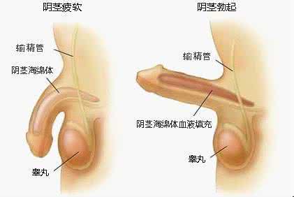 患病种类 阳痿分为哪几种 患病后该怎么办