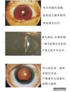 排卵期出血不正常图片 排卵期出血是什么颜色