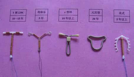 女的必须要上环吗 一定要上环吗
