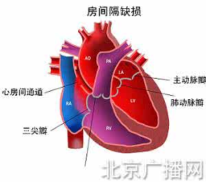 先天性心脏病的寿命 先天性心脏病 先天性心脏病的原因及寿命