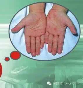 洗衣粉为什么是热的 为什么洗衣粉是热的