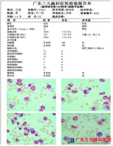 脑脊液细胞学检查 脑脊液细胞学案例分享