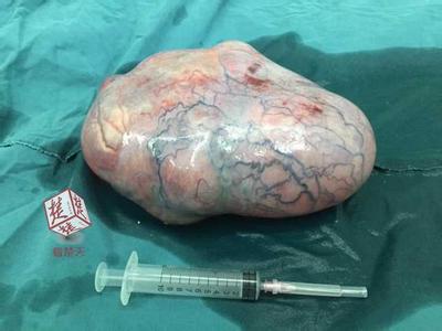 肚脐流水发臭 肚脐发炎发臭怎么办 3岁小女孩下体发炎发臭，奶奶被医生骂惨