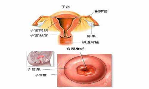 妇科炎症有什么症状 阴道炎常见症状有什么