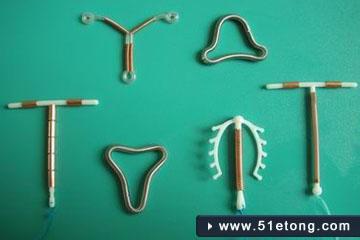 避孕环有几种 放置避孕环后需要注意什么？