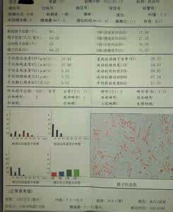 孕前怎样提高精子质量 孕前精子质量如何检查