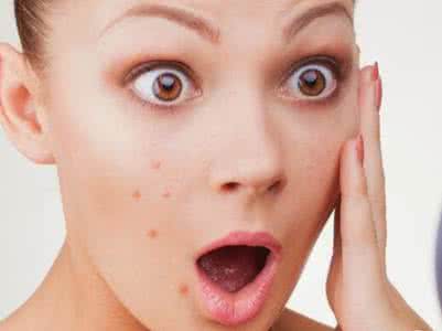 内分泌紊乱的症状 脑癌的早期症状 内分泌紊乱当心是脑癌