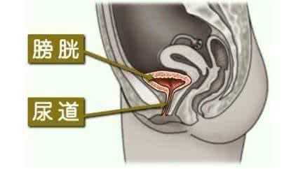 泌尿生殖系统全面检查 男科疾病预防：泌尿生殖系统感染3大信号