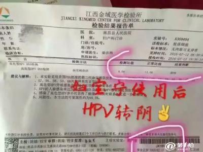放疗后口腔溃疡特效药 冶疗牛皮癣有没有特效药