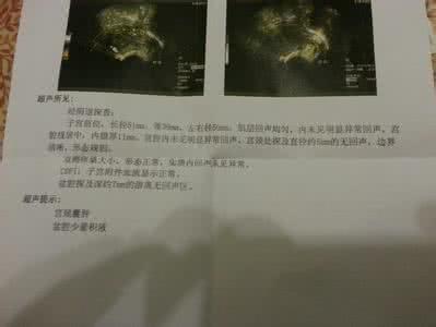 稽留流产的治疗 稽留流产 稽留流产怎么治疗