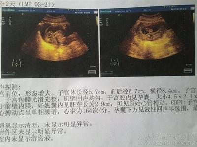 怀孕10天有什么症状 怀孕半个月有什么症状