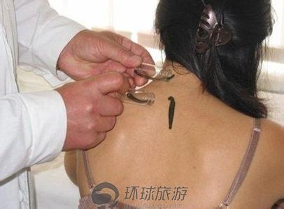 细胞疗法美容 细数那些古怪的美容大法