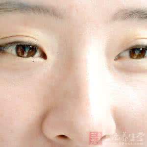 鼻中隔软骨隆鼻 鼻中隔隆鼻 让你知道关于隆鼻的一些事