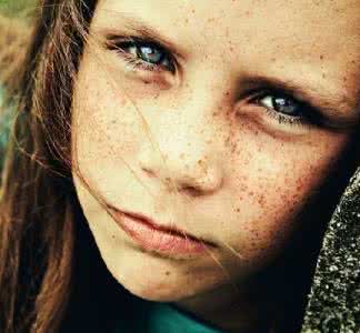 减腰腹赘肉 腰腹赘肉、雀斑几年了，大妈一个偏方治好了